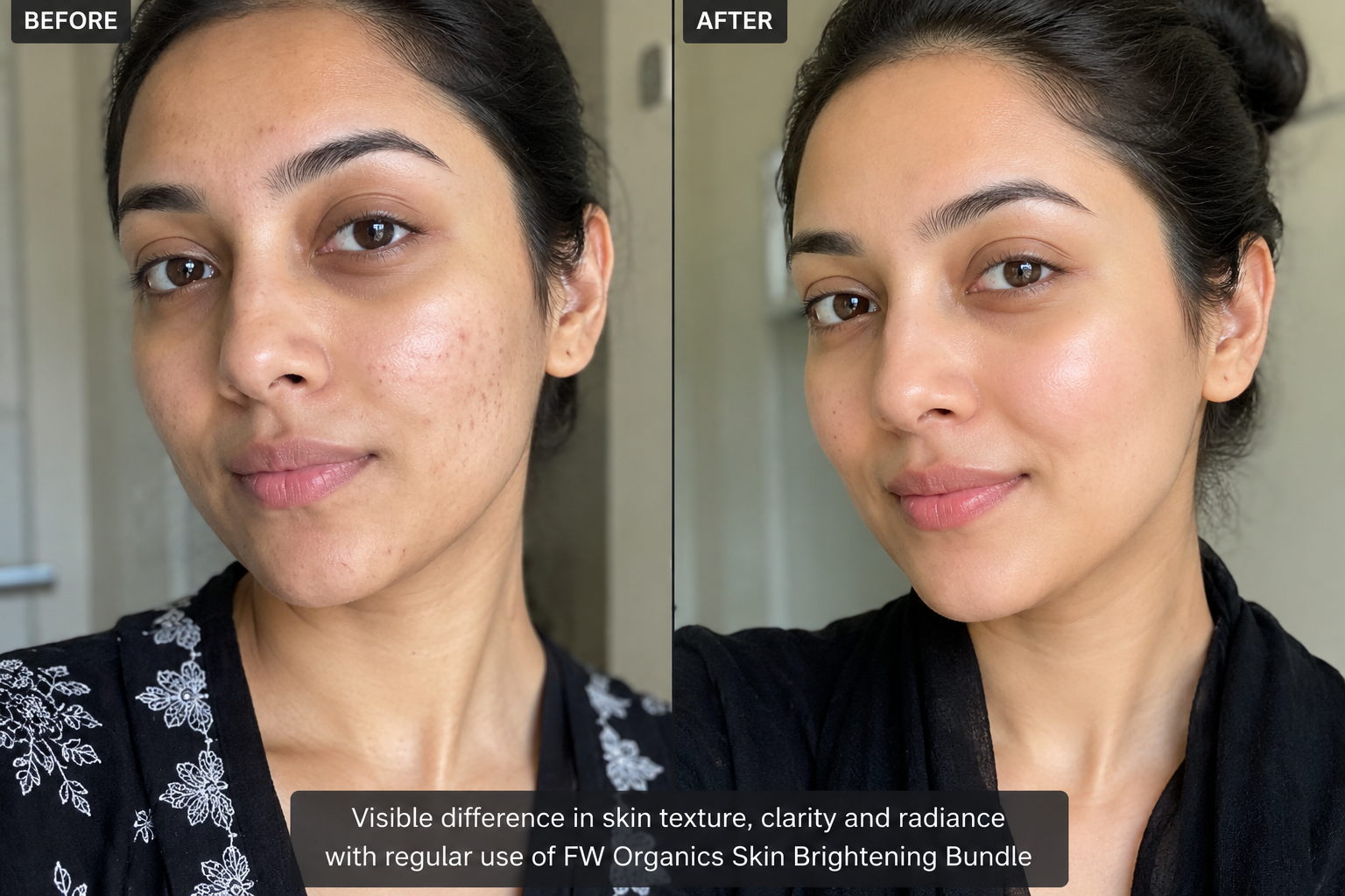 Skin Brightening Bundle