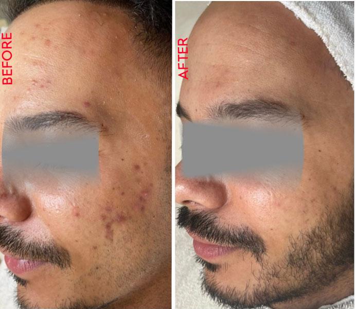 Saffron Intense Repair Cream