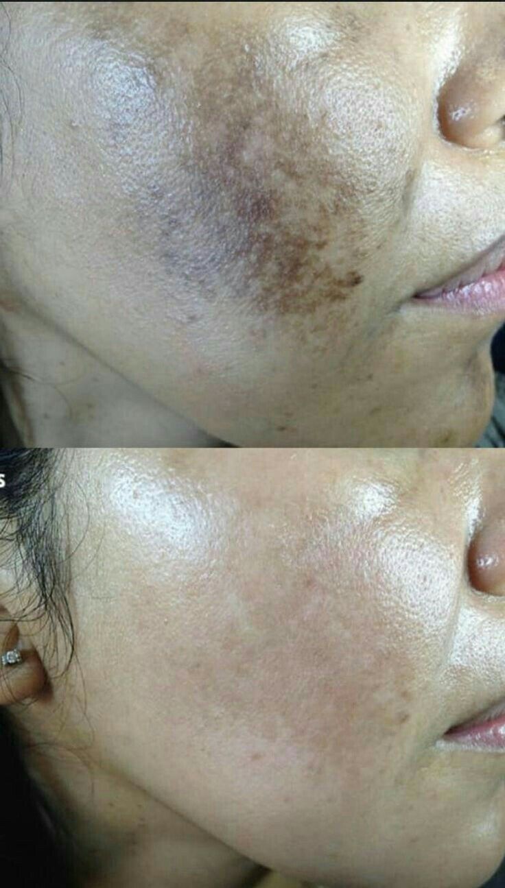 Double Detox Duo