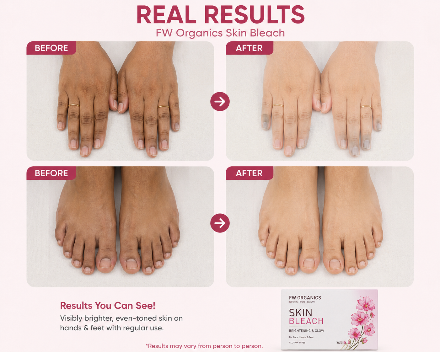 Skin Polisher