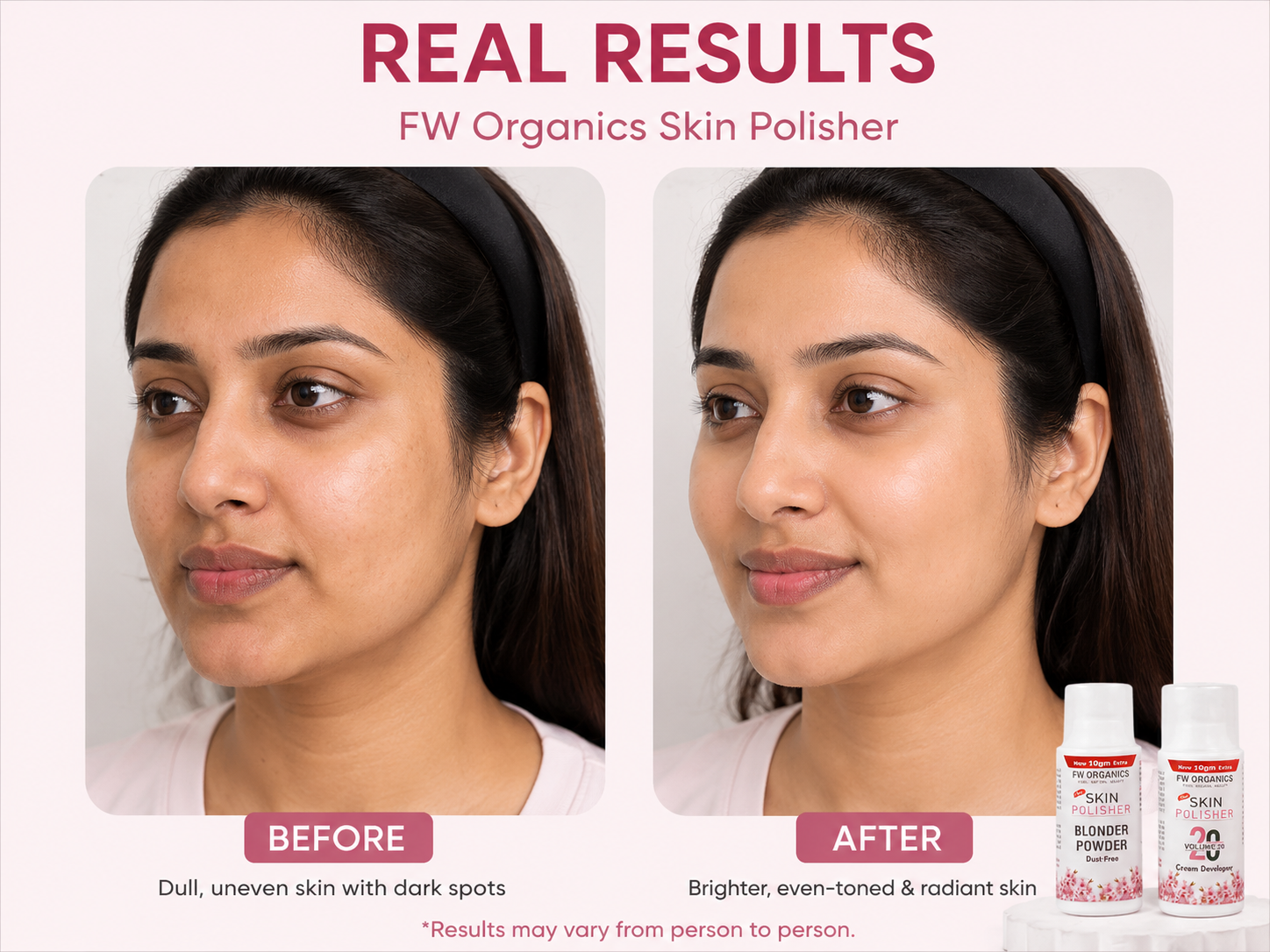 Skin Polisher