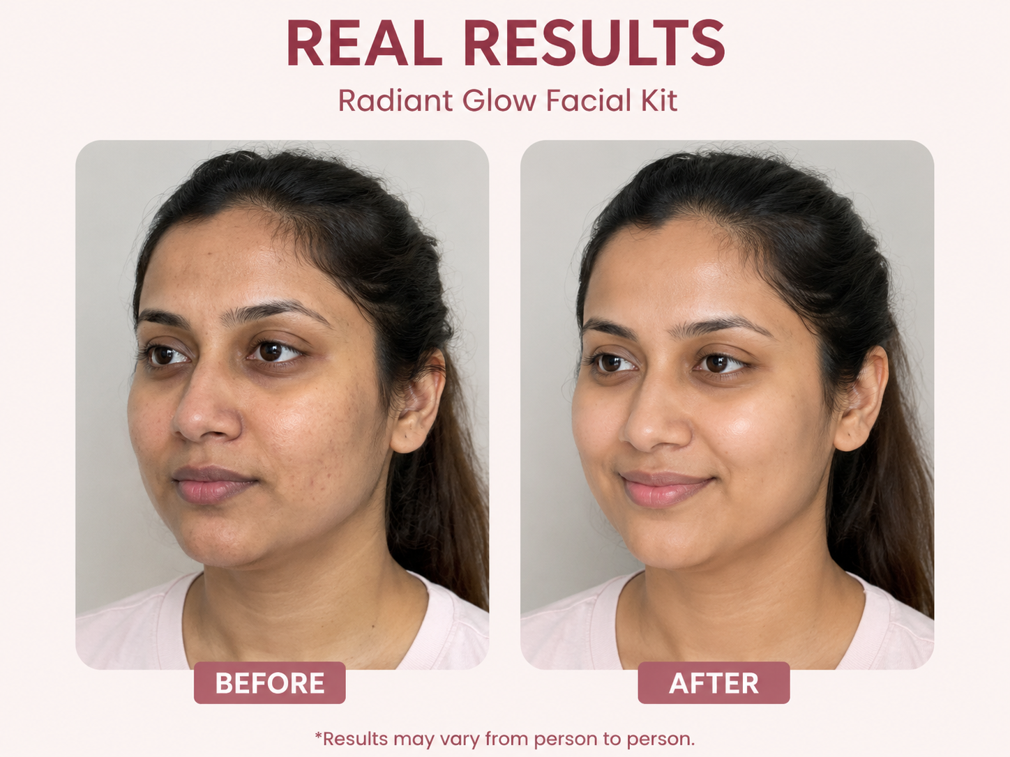 Facial Kit Bundle Deal