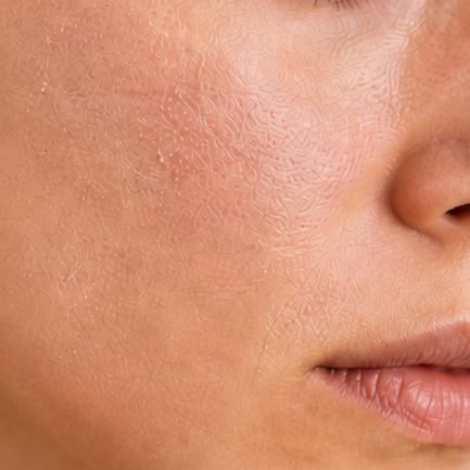 For Dry & Dehydrated Skin