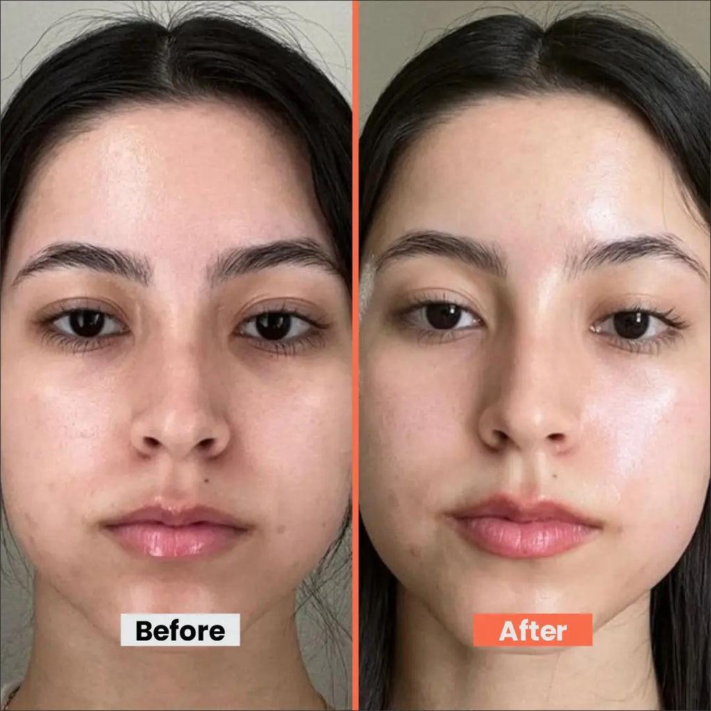 Glow Facial Kit